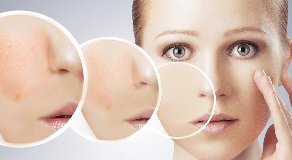 CİLT LEKELERİNİN TEDAVİSİ