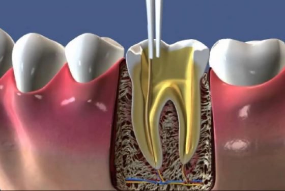 DİŞ ETİ HASTALIKLARI ve DİŞ ESTETİĞİ Aysha