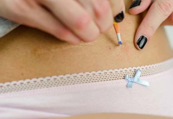 kıl batması neden olur