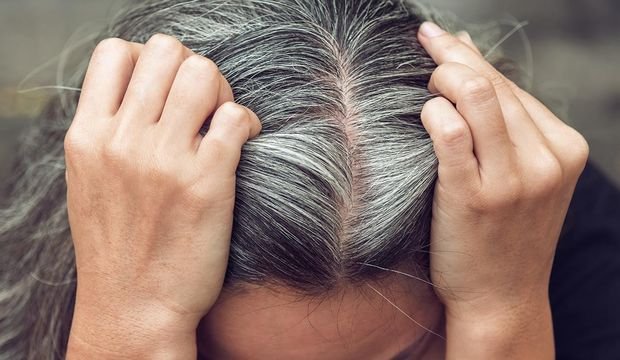 erken saç beyazlaması hangi hastalığın belirtisi erken saç beyazlaması hangi hastalığın belirtisi